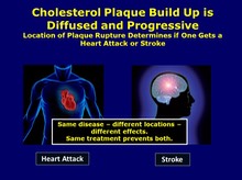 Atherosclerosis is a Diffuse Systemic Disease