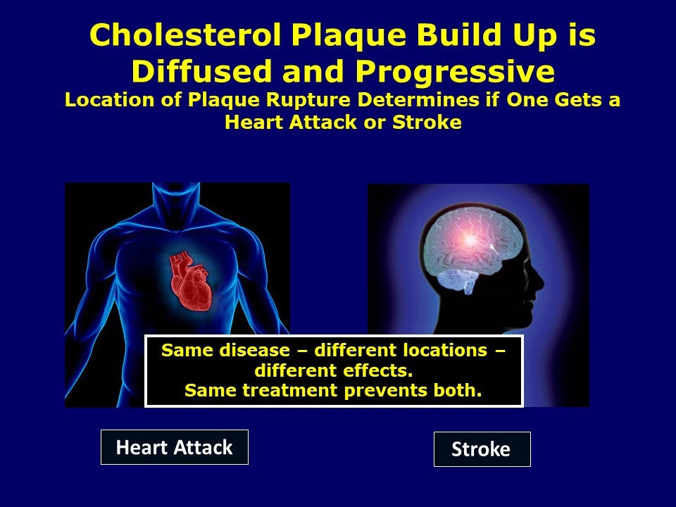 Atherosclerosis is a Diffuse Systemic Disease