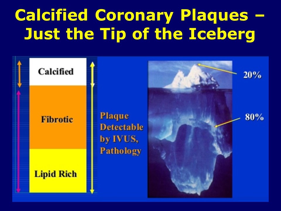 Just the Tip of the Iceberg