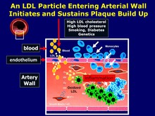 LDL-p Entering the Arterial Wall