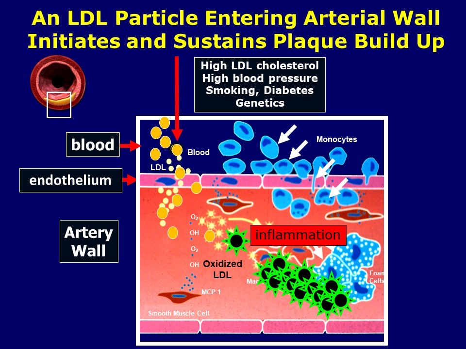 LDL-p Entering the Arterial Wall