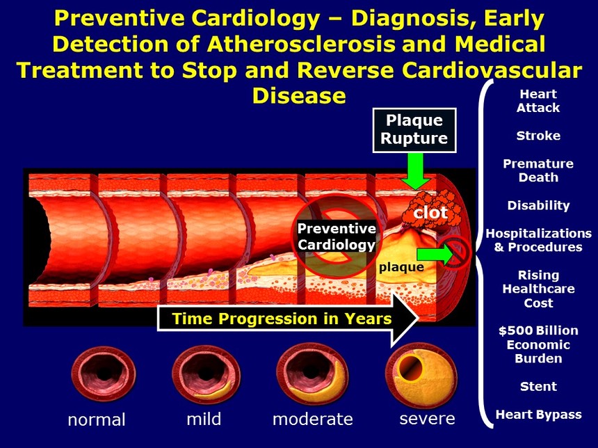 Preventive Cardiology