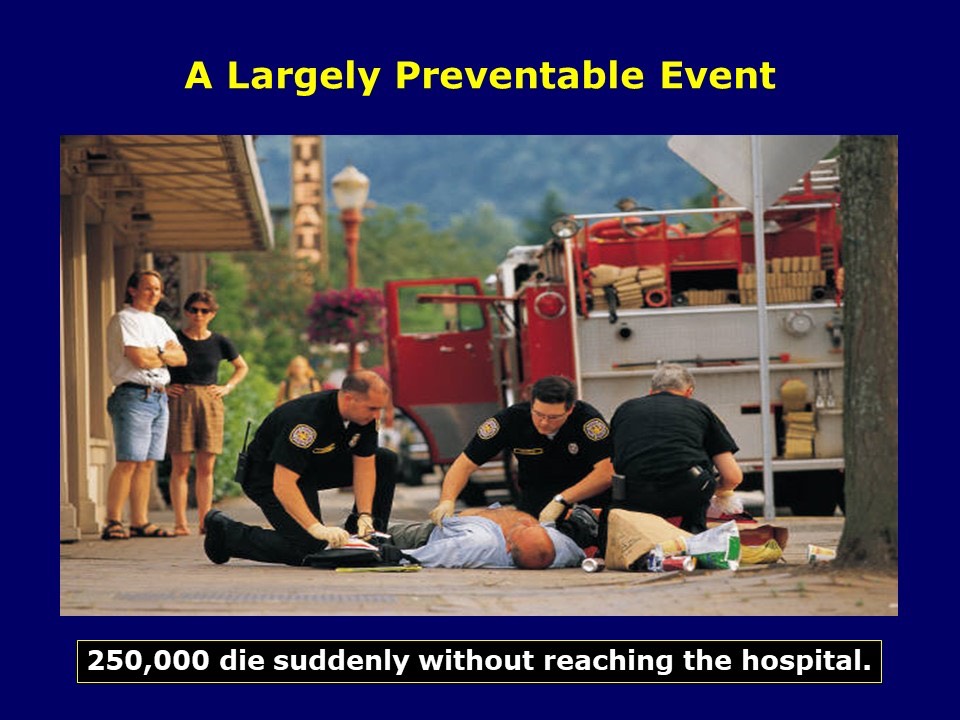 Sudden Cardiac Death - A Common Occurence