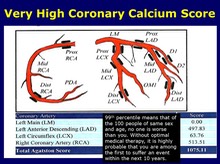 Very High Coronary Calcium Score